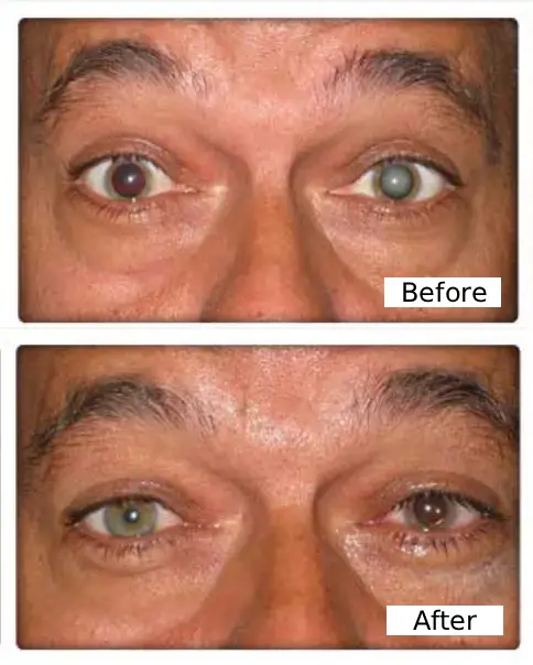 Consult eye doctor