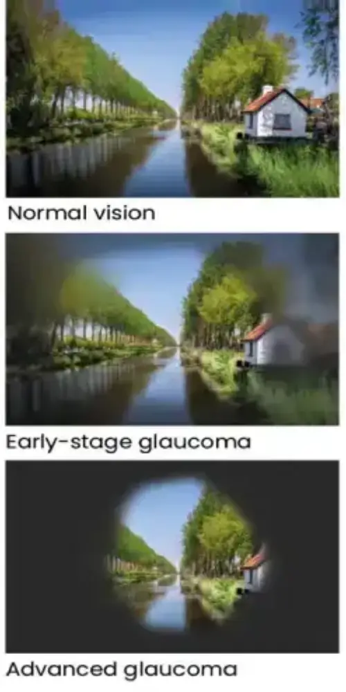 Consult eye doctor