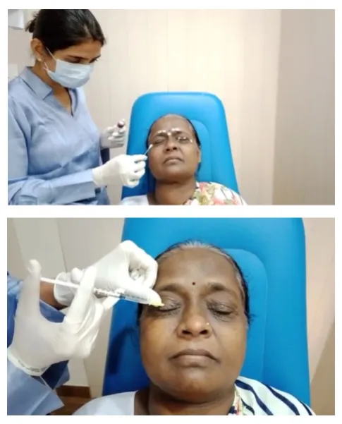 Consult eye doctor