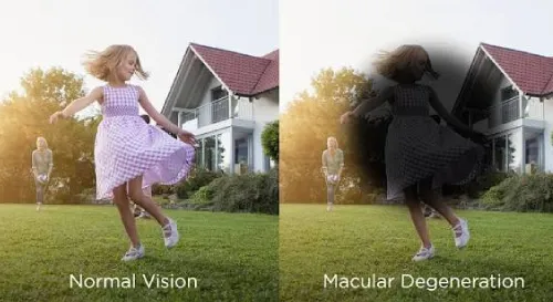 Consult eye doctor
